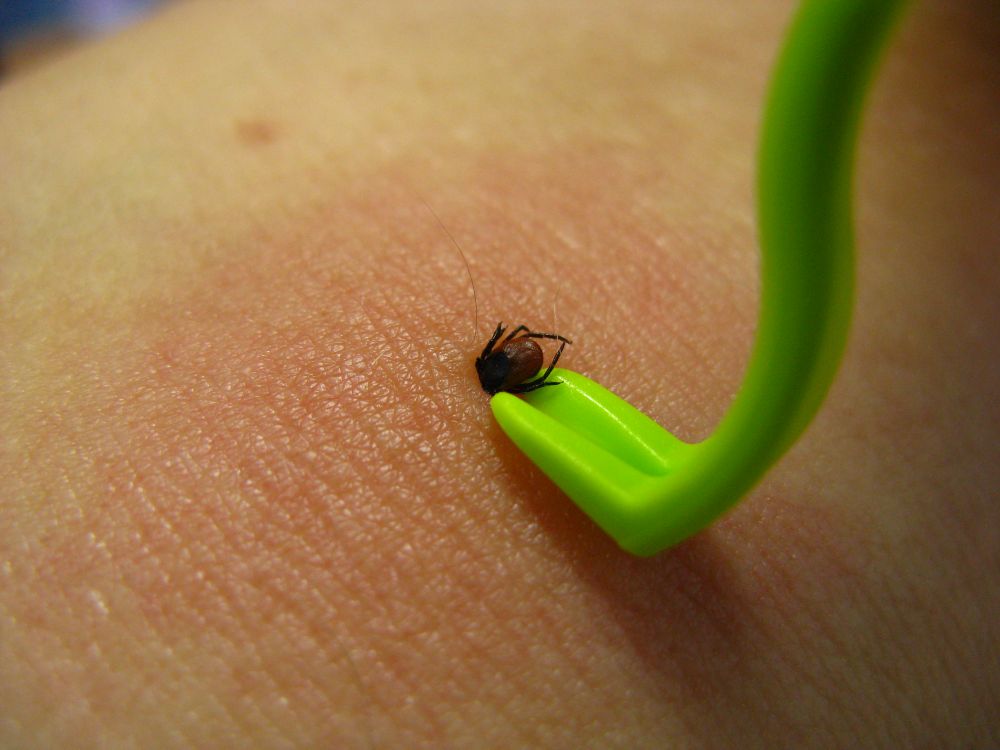 how to remove a tick with a tick twister